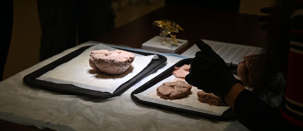 Human brain specimens rest on trays atop absorbent pads, with a gloved hand pointing toward them. A golden anatomical model and papers are visible in the background, suggesting a scientific or educational setting.